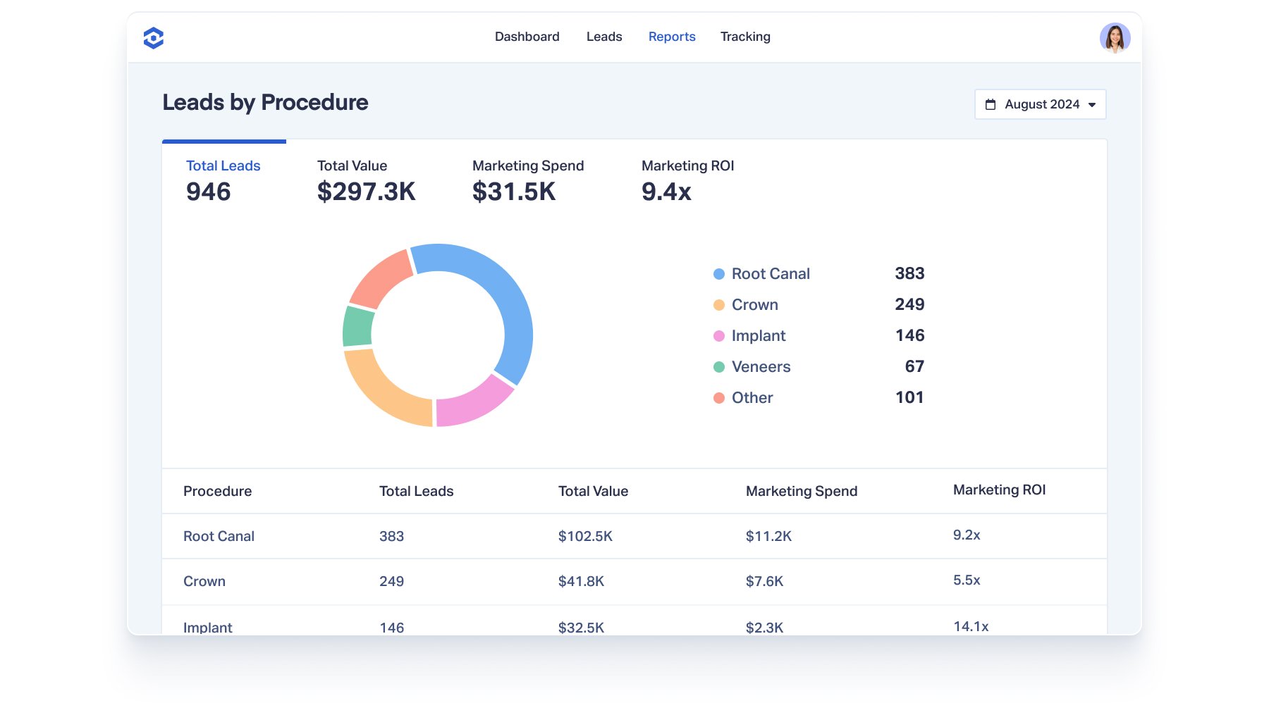 A Leads by Procedure breakdown is shown on the Reports section of the WhatConverts application